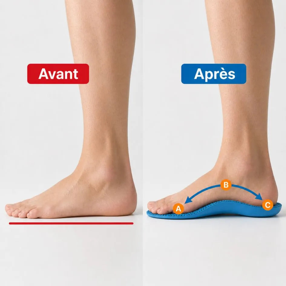 Podélia™ - Semelles de Soutien Plantaire